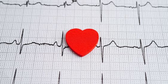 Ausdruck eines Eckokardiogramms (EKG)