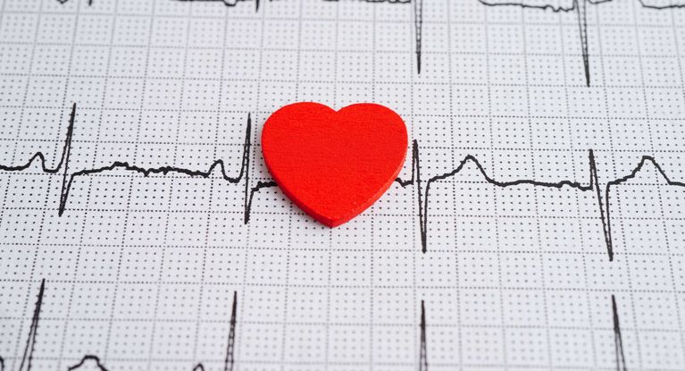 Ausdruck eines Eckokardiogramms (EKG) 