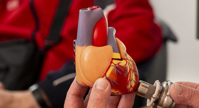 Arzt erklärt Funktion des Herzschrittmachers am Herzmodell